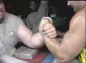 Broken Arm-005.JPG (33233 bytes)